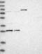 Intraflagellar Transport 81 antibody, NBP1-84557, Novus Biologicals, Western Blot image 