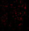 Metastasis-associated in colon cancer protein 1 antibody, A04732, Boster Biological Technology, Immunofluorescence image 