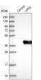 Zebrafish Delta D antibody, NBP1-80646, Novus Biologicals, Western Blot image 