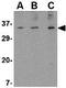 ORAI Calcium Release-Activated Calcium Modulator 3 antibody, GTX85442, GeneTex, Western Blot image 