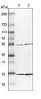 Ubiquitin Conjugating Enzyme E2 D4 (Putative) antibody, NBP1-81769, Novus Biologicals, Western Blot image 