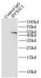 Dyslexia susceptibility 1 candidate gene 1 protein antibody, FNab02597, FineTest, Immunoprecipitation image 