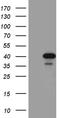 Sulfotransferase 1A3/1A4 antibody, TA811317, Origene, Western Blot image 