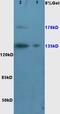 SET-binding protein antibody, orb100884, Biorbyt, Western Blot image 