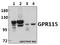 Adhesion G Protein-Coupled Receptor F4 antibody, A14764-1, Boster Biological Technology, Western Blot image 