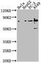 Tensin 4 antibody, CSB-PA810319LA01HU, Cusabio, Western Blot image 