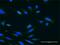 Ubiquitin carboxyl-terminal hydrolase 47 antibody, H00055031-M02, Novus Biologicals, Immunofluorescence image 