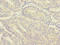 MORN Repeat Containing 5 antibody, LS-C399219, Lifespan Biosciences, Immunohistochemistry paraffin image 