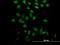 Proline/serine-rich coiled-coil protein 2 antibody, H00196441-B01P, Novus Biologicals, Immunocytochemistry image 