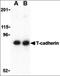 Cadherin 13 antibody, orb86716, Biorbyt, Western Blot image 