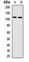 Ubiquitin carboxyl-terminal hydrolase CYLD antibody, LS-C668377, Lifespan Biosciences, Western Blot image 