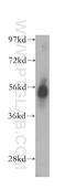 Dipeptidyl Peptidase 4 antibody, 10940-1-AP, Proteintech Group, Western Blot image 