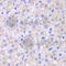 SH2 Domain Containing 1A antibody, A1143, ABclonal Technology, Immunohistochemistry paraffin image 