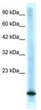 Cyclin Dependent Kinase Inhibitor 2B antibody, TA330369, Origene, Western Blot image 