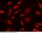 Protein max antibody, 12885-R103, Sino Biological, Immunohistochemistry paraffin image 
