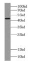 Mitochondrial import inner membrane translocase subunit TIM44 antibody, FNab08701, FineTest, Western Blot image 