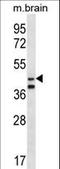 Origin Recognition Complex Subunit 5 antibody, LS-C158503, Lifespan Biosciences, Western Blot image 