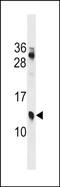 Putative protein KRIP1 antibody, PA5-72091, Invitrogen Antibodies, Western Blot image 