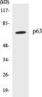Tumor Protein P63 antibody, EKC1430, Boster Biological Technology, Western Blot image 