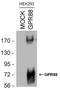 G Protein-Coupled Receptor 88 antibody, PA3-044, Invitrogen Antibodies, Western Blot image 