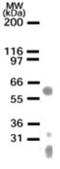 LIM/homeobox protein Lhx1 antibody, GTX13692, GeneTex, Western Blot image 