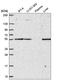 Peptidase, Mitochondrial Processing Alpha Subunit antibody, HPA063735, Atlas Antibodies, Western Blot image 