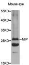 AQP0 antibody, orb135908, Biorbyt, Western Blot image 