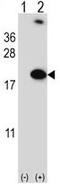 RNA Binding Motif Protein 3 antibody, GTX81472, GeneTex, Western Blot image 
