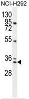 Proline-rich protein BCA3 antibody, AP50347PU-N, Origene, Western Blot image 