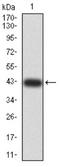 DExD/H-Box Helicase 58 antibody, NBP2-61849, Novus Biologicals, Western Blot image 