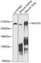 Myosin-X antibody, GTX64824, GeneTex, Western Blot image 