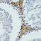 HTRA3 antibody, LS-C749642, Lifespan Biosciences, Immunohistochemistry paraffin image 