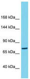 Chromosome 1 Open Reading Frame 112 antibody, TA330692, Origene, Western Blot image 