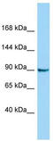 Crooked neck-like protein 1 antibody, TA331902, Origene, Western Blot image 