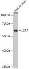 Lecithin-Cholesterol Acyltransferase antibody, A00906, Boster Biological Technology, Western Blot image 