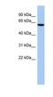 LEM Domain Containing 2 antibody, NBP1-70599, Novus Biologicals, Western Blot image 