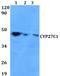 Cytochrome P450 Family 27 Subfamily C Member 1 antibody, A16588, Boster Biological Technology, Western Blot image 
