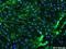 Solute Carrier Family 11 Member 2 antibody, ab55812, Abcam, Immunofluorescence image 