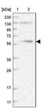 Cytoplasmic dynein 1 light intermediate chain 1 antibody, PA5-57114, Invitrogen Antibodies, Western Blot image 