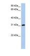 Dickkopf Like Acrosomal Protein 1 antibody, NBP1-62696, Novus Biologicals, Western Blot image 