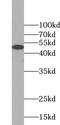 WAS/WASL Interacting Protein Family Member 2 antibody, FNab09511, FineTest, Western Blot image 