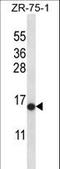 Histone Cluster 2 H2A Family Member B antibody, LS-B10998, Lifespan Biosciences, Western Blot image 