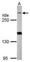 Phosphodiesterase 4D Interacting Protein antibody, NBP2-15031, Novus Biologicals, Western Blot image 