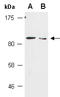 Leucine Rich Repeat Containing G Protein-Coupled Receptor 6 antibody, R2027-6, Abiocode, Western Blot image 