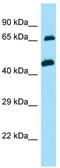Taxilin Alpha antibody, TA337755, Origene, Western Blot image 