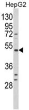Bradykinin Receptor B1 antibody, AP17901PU-N, Origene, Western Blot image 