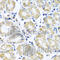 NADH:Ubiquinone Oxidoreductase Subunit B10 antibody, A3982, ABclonal Technology, Immunohistochemistry paraffin image 