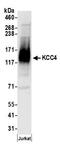 Solute carrier family 12 member 7 antibody, A304-442A, Bethyl Labs, Western Blot image 