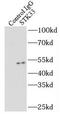 Serine/Threonine Kinase 33 antibody, FNab08334, FineTest, Immunoprecipitation image 