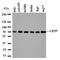 Cholesteryl Ester Transfer Protein antibody, orb99181, Biorbyt, Western Blot image 